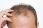 बालों का झड़ना कैसे रोकें 25 तरीके, Home Remedies For Stop Hair Fall Treatment In Hindi,Nayichetana.com, Hair Fall Kaise Roke,Balo ka jhadna kaise roke hindi