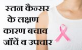 स्तन कैन्सर के लक्षण कारण बचाव जाँचें व उपचार,Breast Cancer Symptoms Causes Stages Types In Hindi,Breast CancerBreast Cancer se bachav,stan cancer kya hai