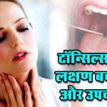 Tonsillitis couses and treatment