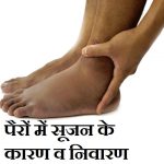 पैरों में सूजन के कारण व निवारण,Swelling in Feet Causes Treatment in Hindi,pairo me sujan ke kaaran upchar,legs swelling problems in hindi