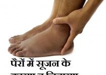 पैरों में सूजन के कारण व निवारण,Swelling in Feet Causes Treatment in Hindi,pairo me sujan ke kaaran upchar,legs swelling problems in hindi