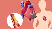 कोलेस्टेराल कम कैसे करे 12 उपाय,How to Reduce Cholesterol in Hindi,Cholesterol kam kaise kare,Cholesterol kam karne ke tarike,kolestrol upay