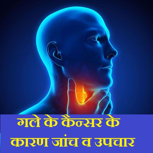 Throat Cancer Symptoms Causes in Hindi,गले के कैन्सर के कारण जांच उपचार,gale ke cancer ke upchar, gale cancer ke lakshan, gale ka kansar kya h